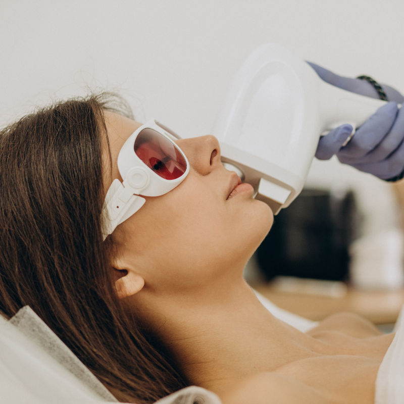 Hormonal hair growth in PCOS